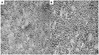 Prototheca zopfii Induced Ultrastructural Features Associated with Apoptosis in Bovine Mammary Epithelial Cells